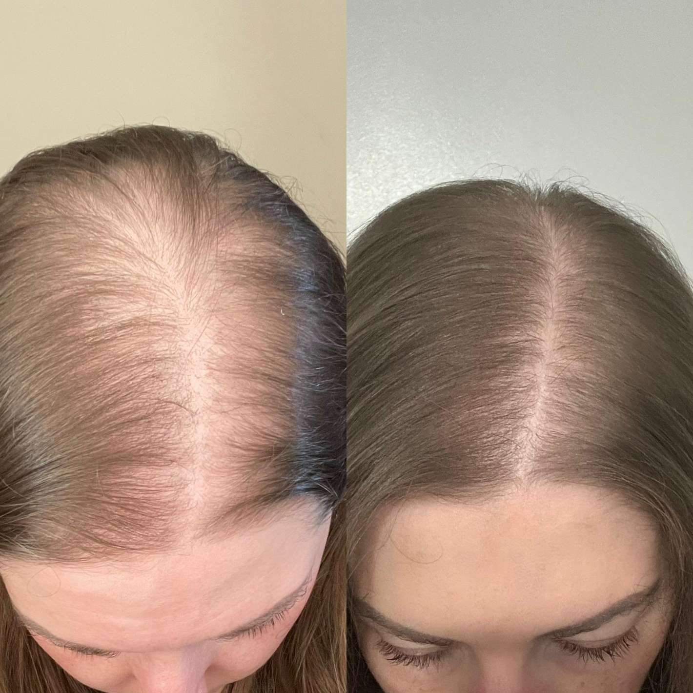 r4k3p0tpquod1.png__PID:bd5be4be-eba0-4126-ac0c-3f806752b953